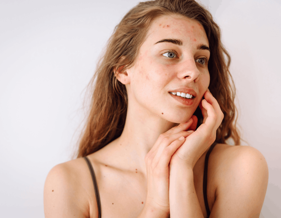 A young woman with clear skin smiling gently.