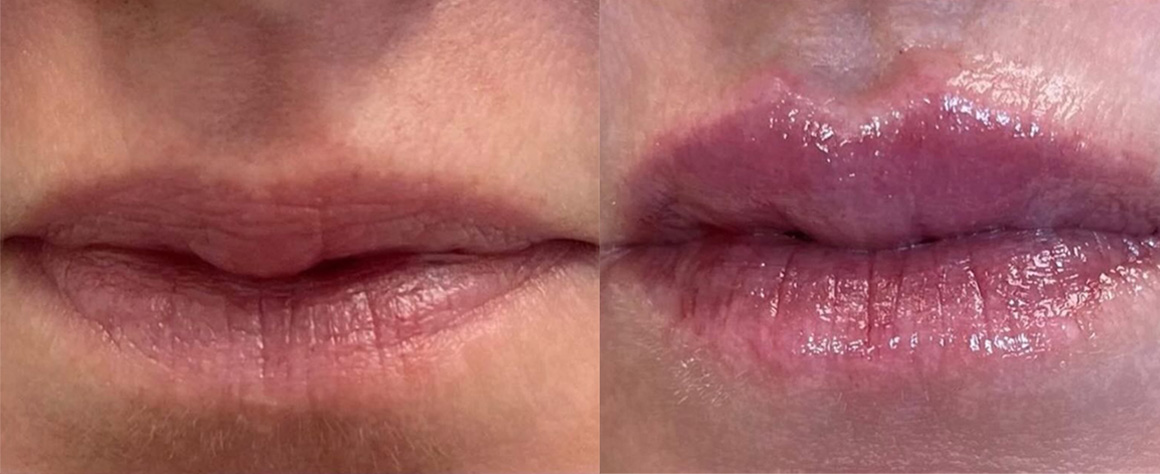 Close-up of lips before and after applying glossy lip balm.